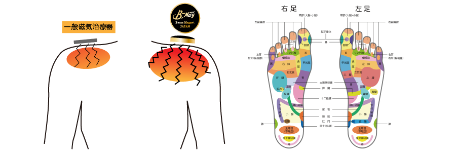 B-Mag(ビーマグ24)と一般磁気治療器との比較